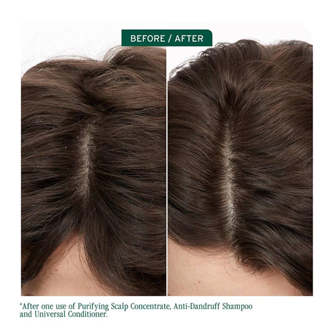 Biolage Scalp Sync Anti Dandruff Shampoo 400ml