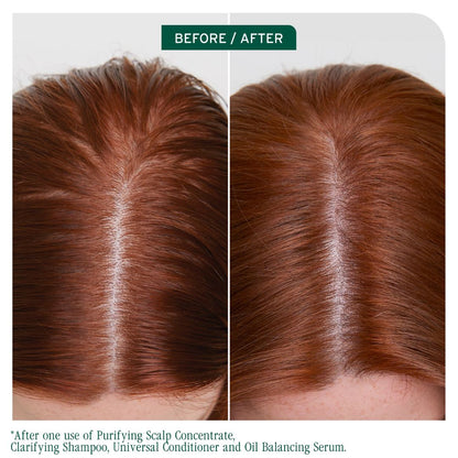 Biolage Scalp Sync Calming Shampoo 400ml