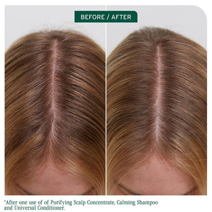 Biolage Scalp Sync Universal Conditioner 236ml