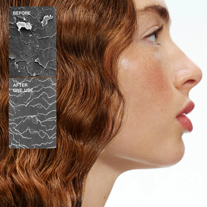 Before and after comparison of a hair product on a woman's scalp.